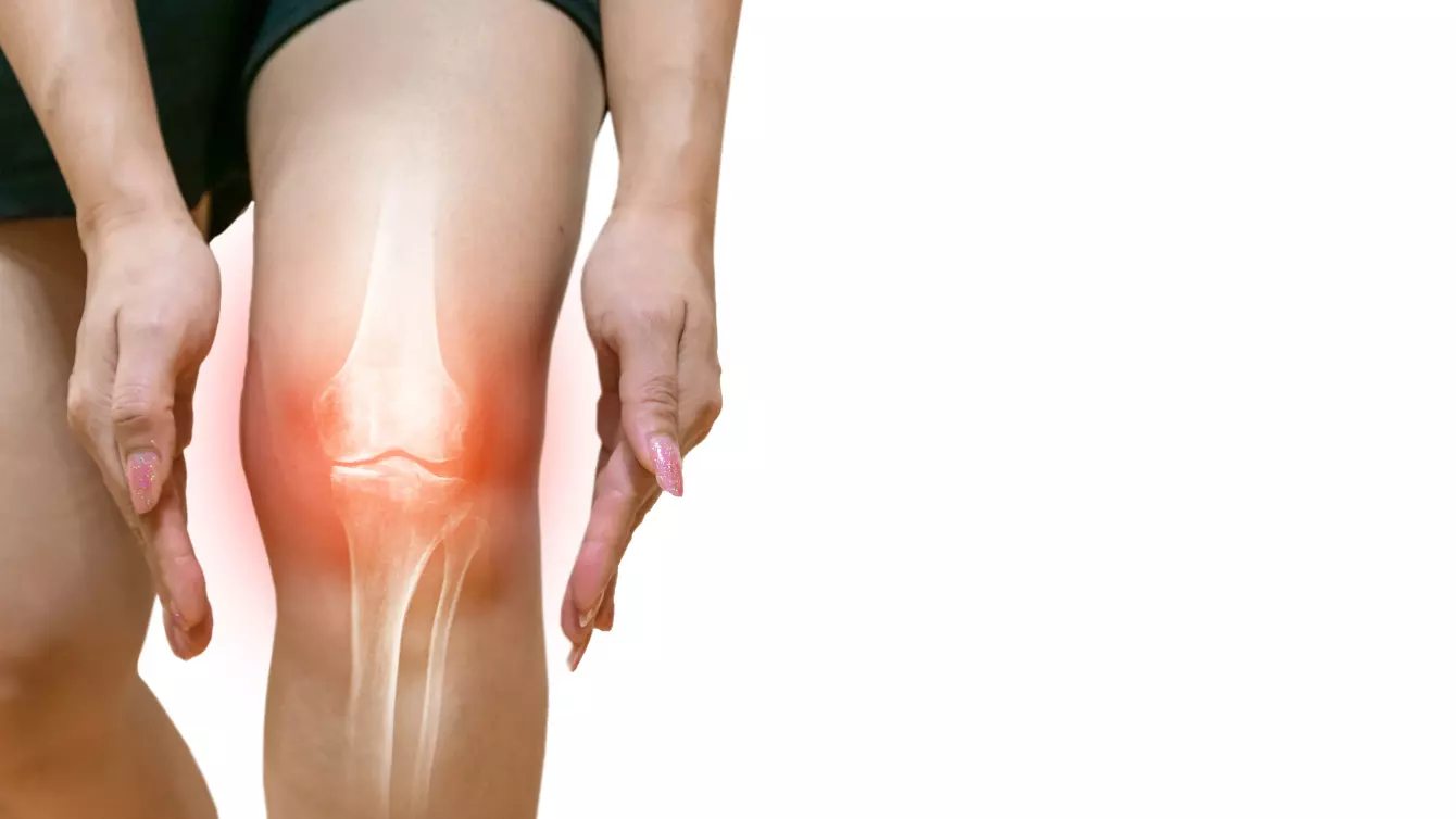 les traitements naturels pour soulager la douleur de l’arthrose du genou